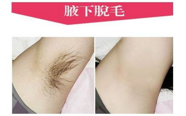 南通哪家醫(yī)院的微針祛除木偶紋技術(shù)好？2023年排行評(píng)價(jià)極高的南通整形美容醫(yī)院！