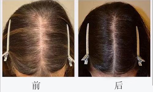 廣州哪些醫(yī)院可靠，專業(yè)進行臉部疤痕切除整形美容？2023年十大排名公開！