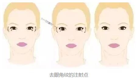 2023年北京鼻端缺損整形美容醫(yī)院前十強排名揭曉！知名度爆棚的醫(yī)療機構(gòu)盤點！