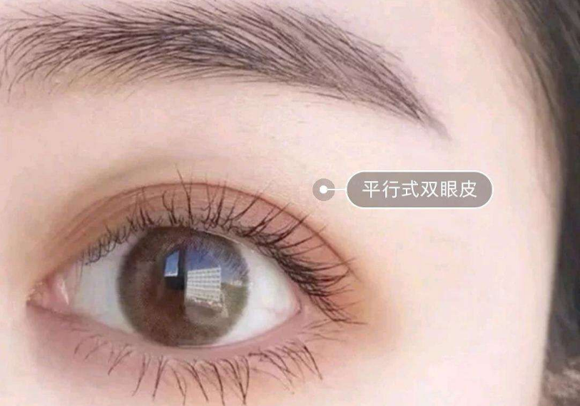 鄭州最受推崇的雙眼皮整形專家推薦榜單露臉！多位實(shí)力經(jīng)驗(yàn)高手霸占榜首！