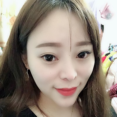 術(shù)前矮低平，術(shù)后高挺翹~肋軟骨隆鼻效果好的不得了！