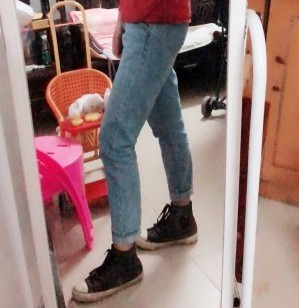胖腿女孩兒福利分享：吸脂瘦大腿的蛻變，效果值得點(diǎn)贊！
