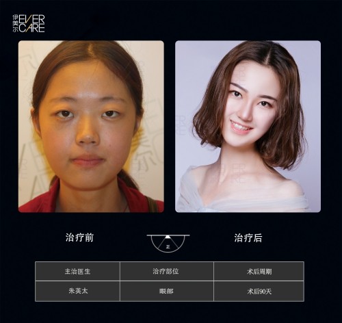 阿爾法9°美眼，打開視界，美無止境