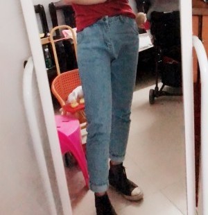 胖腿女孩兒福利分享：吸脂瘦大腿的蛻變，效果值得點贊！