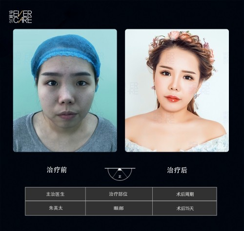 阿爾法9°美眼，打開視界，美無止境