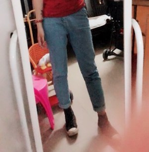 胖腿女孩兒福利分享：吸脂瘦大腿的蛻變，效果值得點(diǎn)贊！