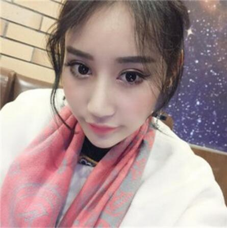 雙眼皮失敗丑的不敢見(jiàn)人，昆明麗都整形雙眼皮修復(fù)案例分享