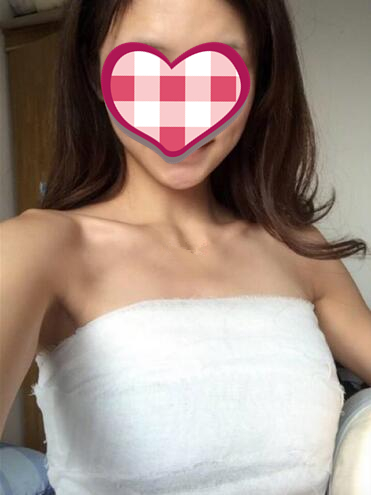 青島集美蜜桃假體隆胸案例術后20天效果
