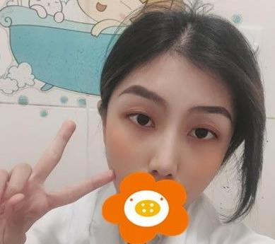 救命，周杰群做的耳軟骨隆鼻恢復(fù)后鼻背線條也太好看了吧