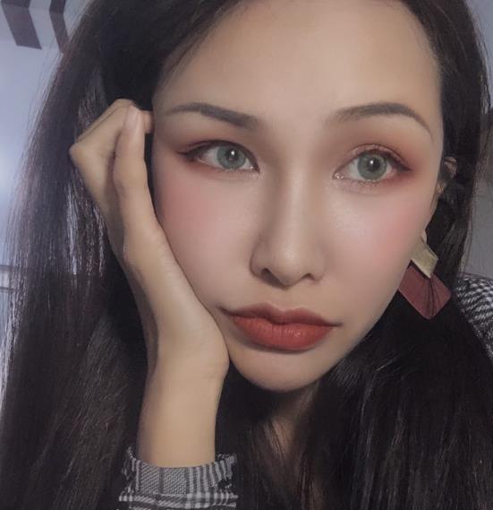 長春中研整形黃帝云鼻頭縮小案例術后三個月效果