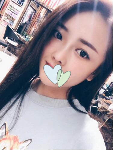 廈門海峽整形鼻綜合案例分享，這鼻子可以滑滑梯了