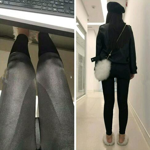 4800做的大腿吸脂，效果竟然還不錯(cuò)