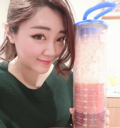 揭陽美萊整形手臂吸脂案例分享，輕松告別拜拜肉