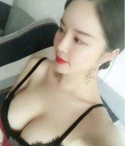福州海峽假體隆胸案例術后兩個月