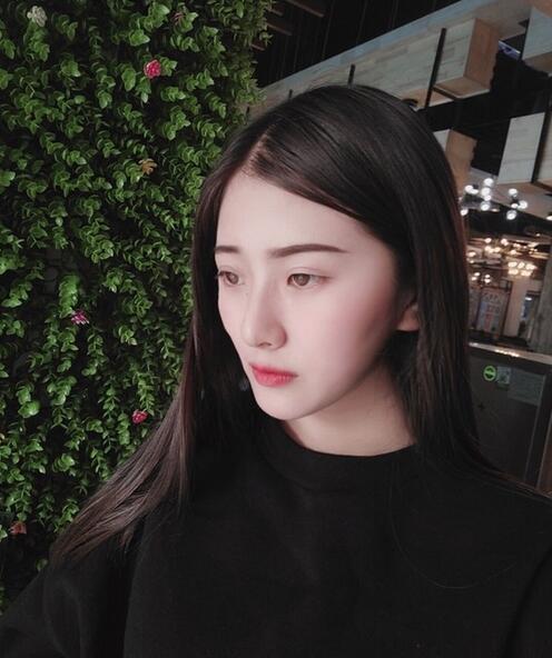 杭州時光磨骨案例術后兩個月效果