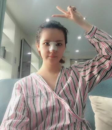 北京葉子整形肋軟骨隆鼻案例反饋，這鼻子是真實存在的嗎
