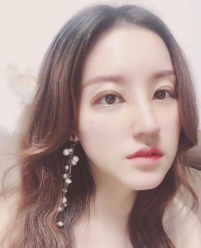 北京葉子整形肋軟骨隆鼻案例術后一個月