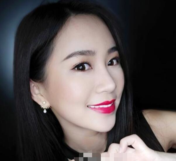 深圳鵬程整形劉冰做的鼻子真絕了，跟我想象的一模一樣
