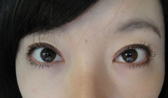 在鄭州望京做全切雙眼皮+開外眼角，術(shù)后效果確實沒讓我失望