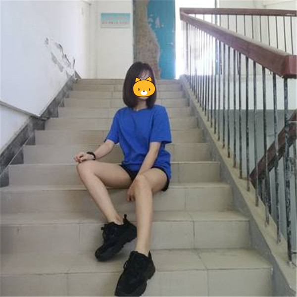 中山美南華整形大腿吸脂三個月