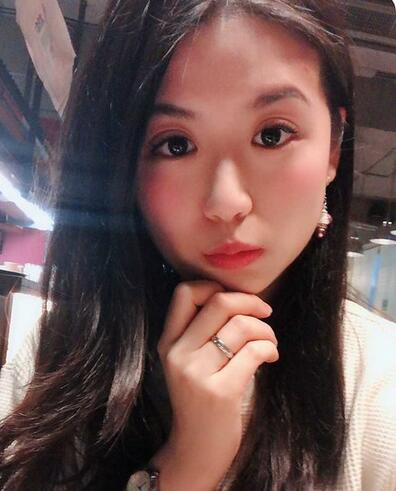 汕頭曙光整形皮秒激光祛斑一個(gè)月效果反饋，斑沒了