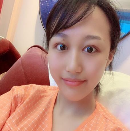 上海華美楊亞益做眼部修復案例效果對比圖