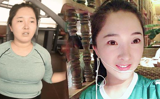 埋線減肥是什么？中醫(yī)診所里推出的埋線減肥真有用嗎，有科學(xué)依據(jù)嗎？