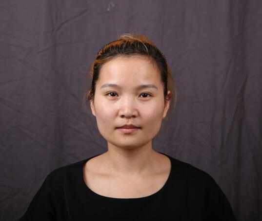 廈門(mén)華美名媛整形醫(yī)生賈虹下頜角削骨案例效果對(duì)比圖！