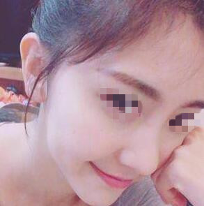 耳軟骨隆鼻手術之前