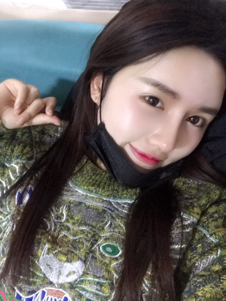 北京星美李寧輝進口膨體隆鼻案例效果對比圖，鼻子自然又美麗