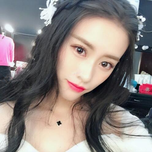 長春銘妍醫(yī)療美容門診部做雙眼皮怎么樣？長春銘妍雙眼皮案例分享