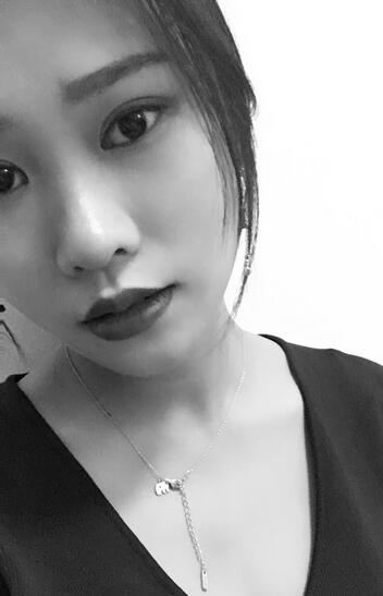 上海伊美爾港華整形醫(yī)生師麗麗做雙眼皮怎么樣？師麗麗雙眼皮案例分享