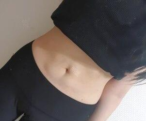 廣州星團(tuán)醫(yī)學(xué)整形醫(yī)生顧鵬做腹部吸脂效果怎么樣？顧鵬腹部吸脂案例展示