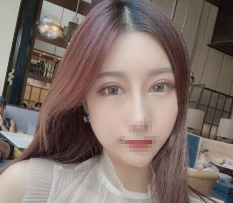 北京彤美整形醫(yī)院專家李長(zhǎng)賦做鼻部綜合整形怎么樣？