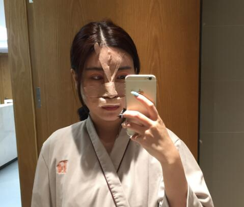 北京彤美整形醫(yī)院專家李長(zhǎng)賦做鼻部綜合整形怎么樣？
