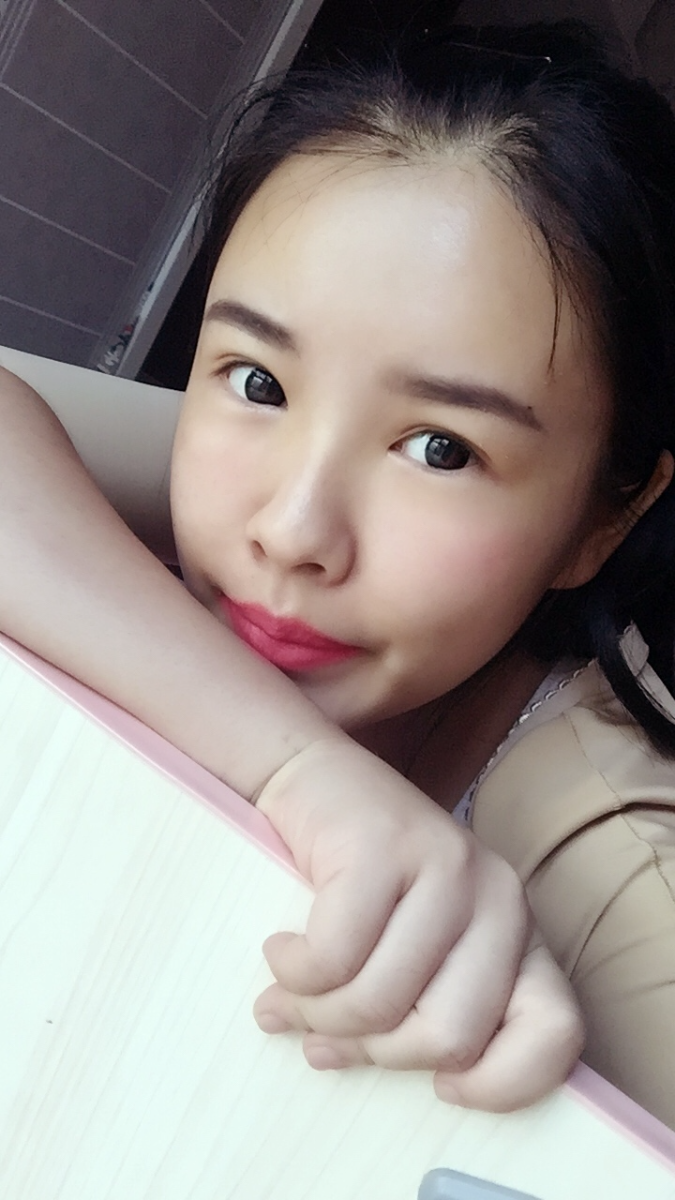 西安莎曼妃醫(yī)療美容醫(yī)院醫(yī)生樸俊做自體脂肪豐太陽穴效果怎么樣？