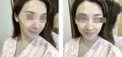 恢復過程