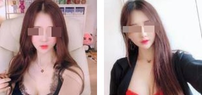 沈陽杏林整形美容醫(yī)院崔昌墉醫(yī)生做假體隆胸技術(shù)怎么樣？附案例