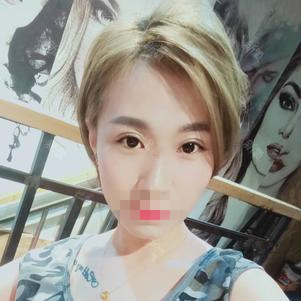 上海臻景醫(yī)療整形醫(yī)生李載成做雙眼皮怎么樣？李載成雙眼皮手術(shù)案例