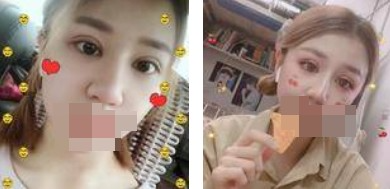 做了全切雙眼皮不僅外表變美了，內(nèi)心也更加自信了
