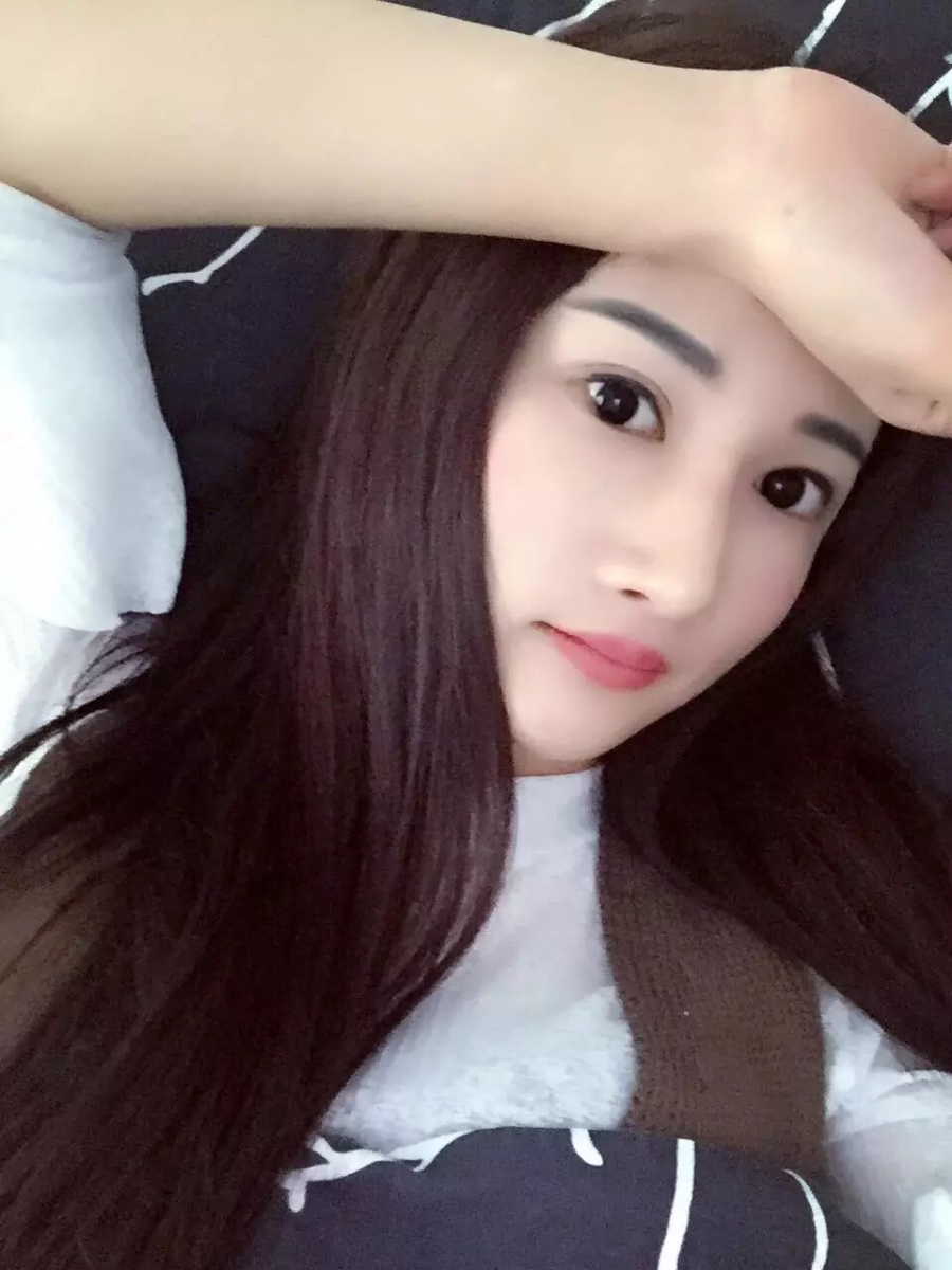 廣州廣大整形醫(yī)生秦瑜做顴骨內(nèi)推+下頜角整形怎么樣？附案例