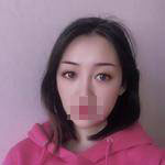 做完雙眼皮手術(shù)眼睛更加迷人了，眼睛自己會(huì)撩小哥哥