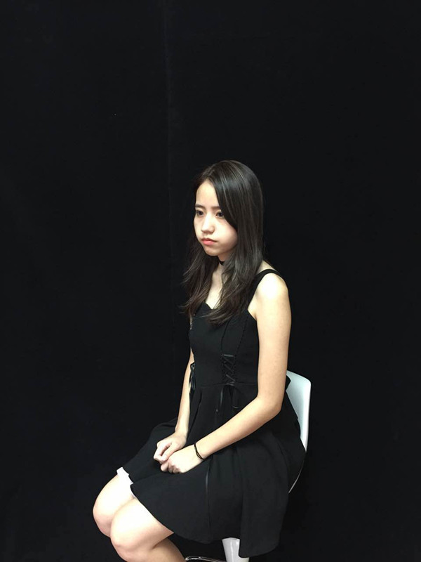 佛山曙光金子醫(yī)學整形醫(yī)生劉洲尉做埋線隆鼻技術怎么樣？附案例