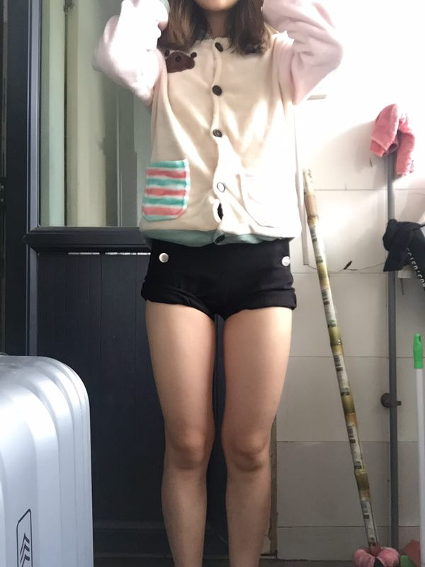 成都美立方整形醫(yī)院黃華醫(yī)生做大腿吸脂怎么樣？附大腿吸脂案例
