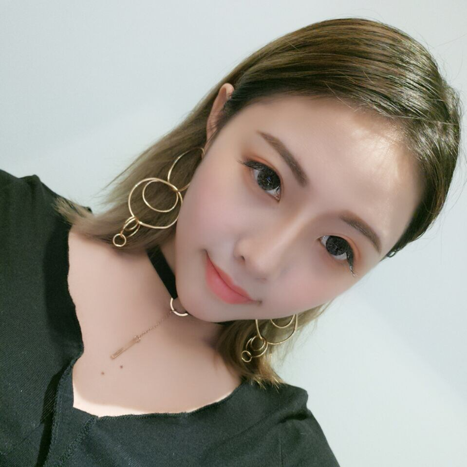 廣州中科美整形醫(yī)生徐長(zhǎng)亮做切開(kāi)雙眼皮怎么樣？附切開(kāi)雙眼皮案例