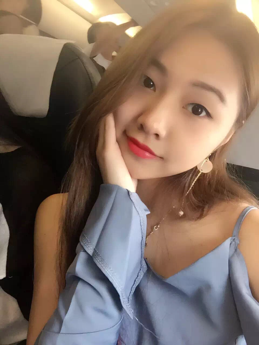 廣州中科美整形醫(yī)生徐長(zhǎng)亮做切開(kāi)雙眼皮怎么樣？附切開(kāi)雙眼皮案例