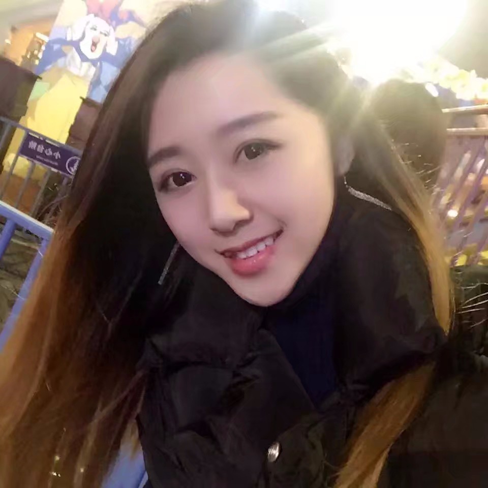西安米蘭柏羽整形醫(yī)院李旭平做切開(kāi)雙眼皮效果怎么樣？附案例