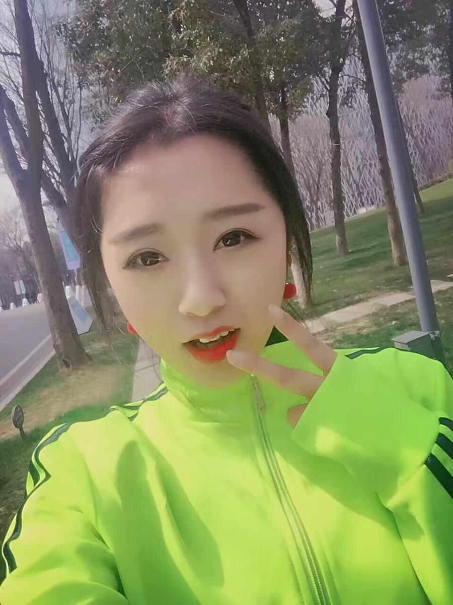 西安米蘭柏羽整形醫(yī)院李旭平做切開雙眼皮效果怎么樣？附案例