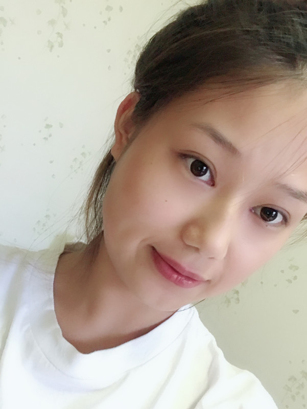 西安藝星整形醫(yī)院徐智慧醫(yī)生做埋線提升怎么樣？附西安藝星埋線提升案例