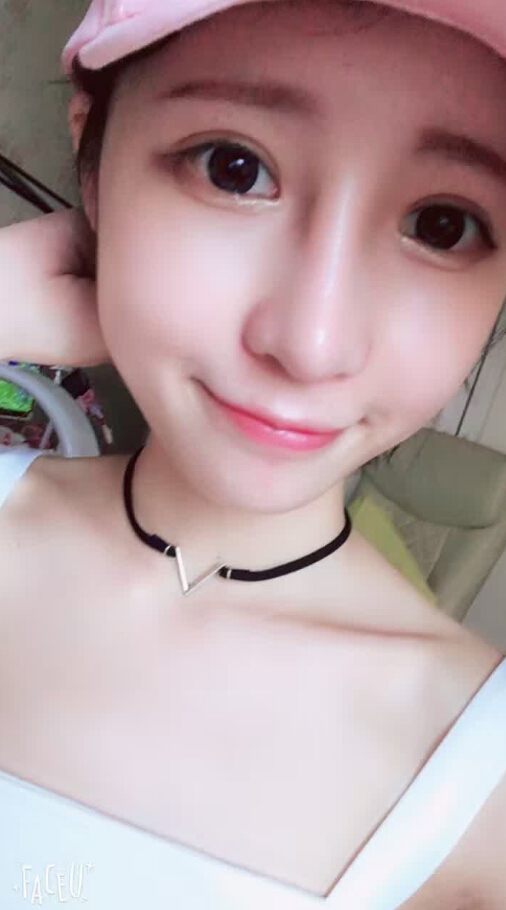長沙愛思特整形醫(yī)院陳星光醫(yī)生做鼻部多項+自體脂肪隆鼻+切開雙眼皮+開外眼角案例